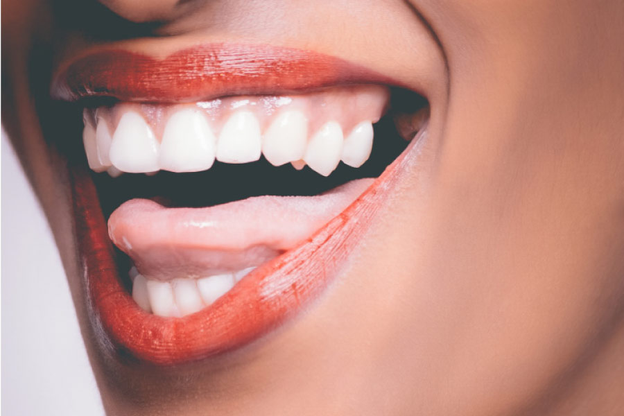 closeup of a woman's big smile showing off her tooth enamel